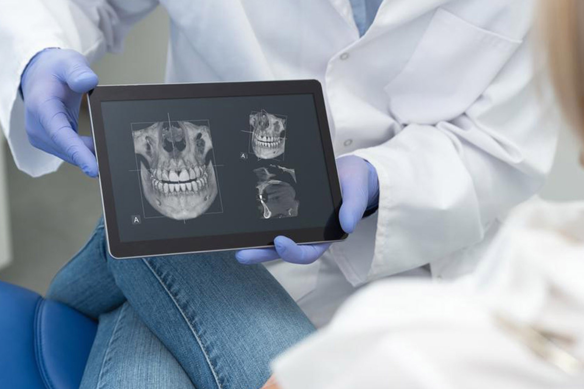 3D Çene ve Diş Tomografisi Tedavi Resim